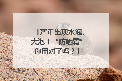 严重出现水泡、大泡！“防晒霜”你用对了吗？